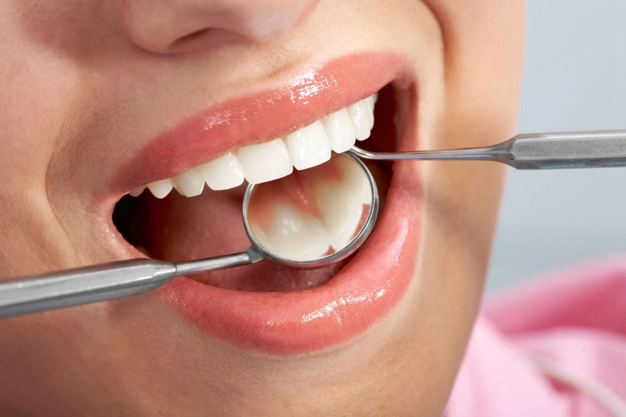 A dentist examining a patient’s teeth with a dental mirror during a check-up